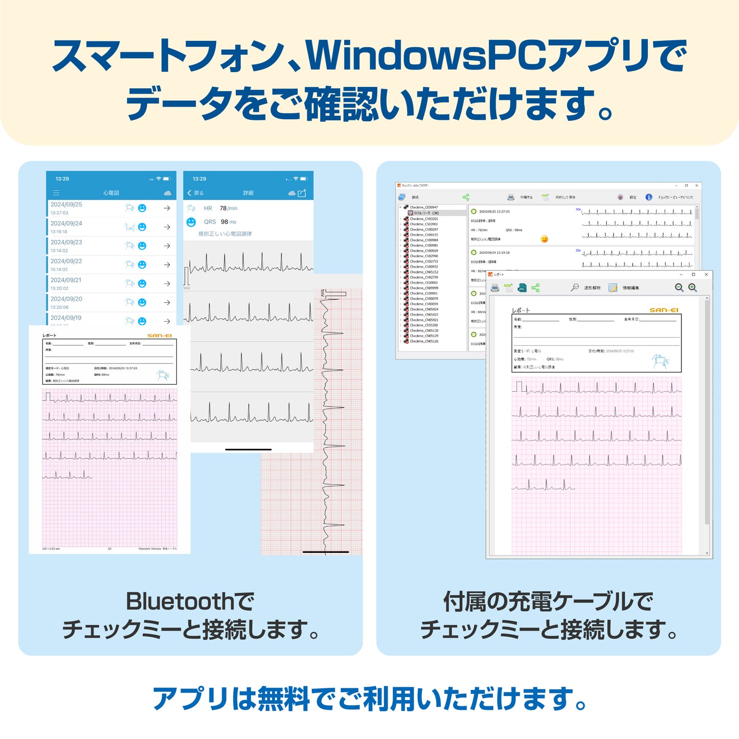 チェックミーECGアドバンス《充電アダプタセット》